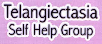 https://cdn.bad.org.uk/uploads/2021/12/29200132/Telangiectasia-Self-Help-Group.jpeg
